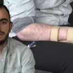 Başına metal parça saplanan işçi, 17,9 milyon TL tazminat kazandı