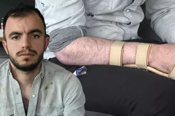 Başına metal parça saplanan işçi, 17,9 milyon TL tazminat kazandı